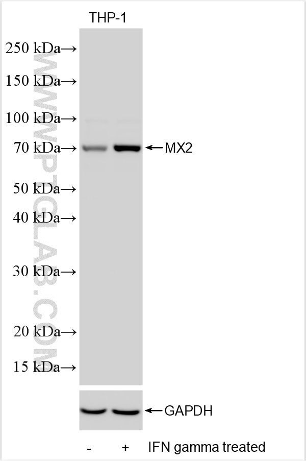 Western Blot (WB) analysis of various lysates using MX2 Polyclonal antibody (13278-1-AP)