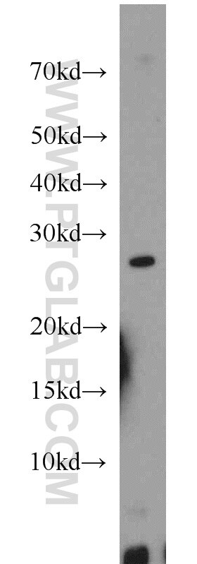 Western Blot (WB) analysis of mouse skeletal muscle tissue using MXD1 Polyclonal antibody (17888-1-AP)