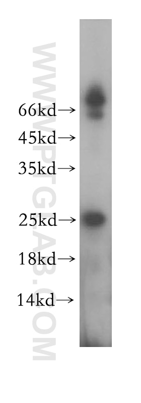 Western Blot (WB) analysis of mouse skeletal muscle tissue using MXD1 Polyclonal antibody (17888-1-AP)