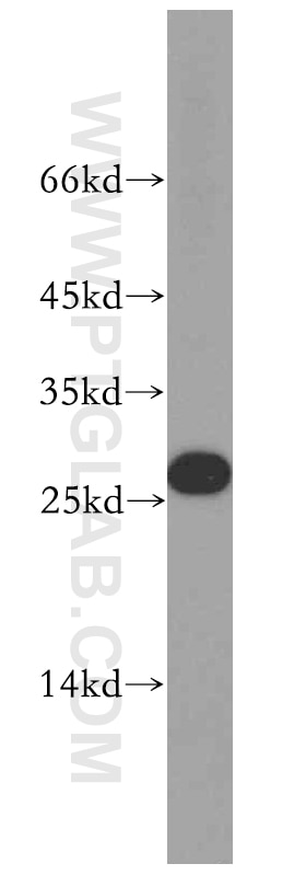 Western Blot (WB) analysis of HepG2 cells using MXD1 Polyclonal antibody (19547-1-AP)