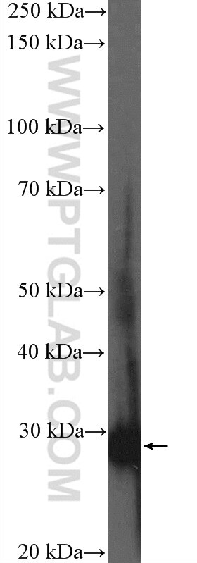 Western Blot (WB) analysis of mouse brain tissue using MXI1 Polyclonal antibody (12360-1-AP)