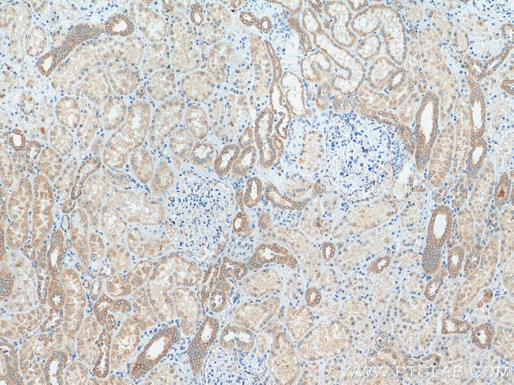 Immunohistochemistry (IHC) staining of human kidney tissue using MXRA5 Polyclonal antibody (25472-1-AP)