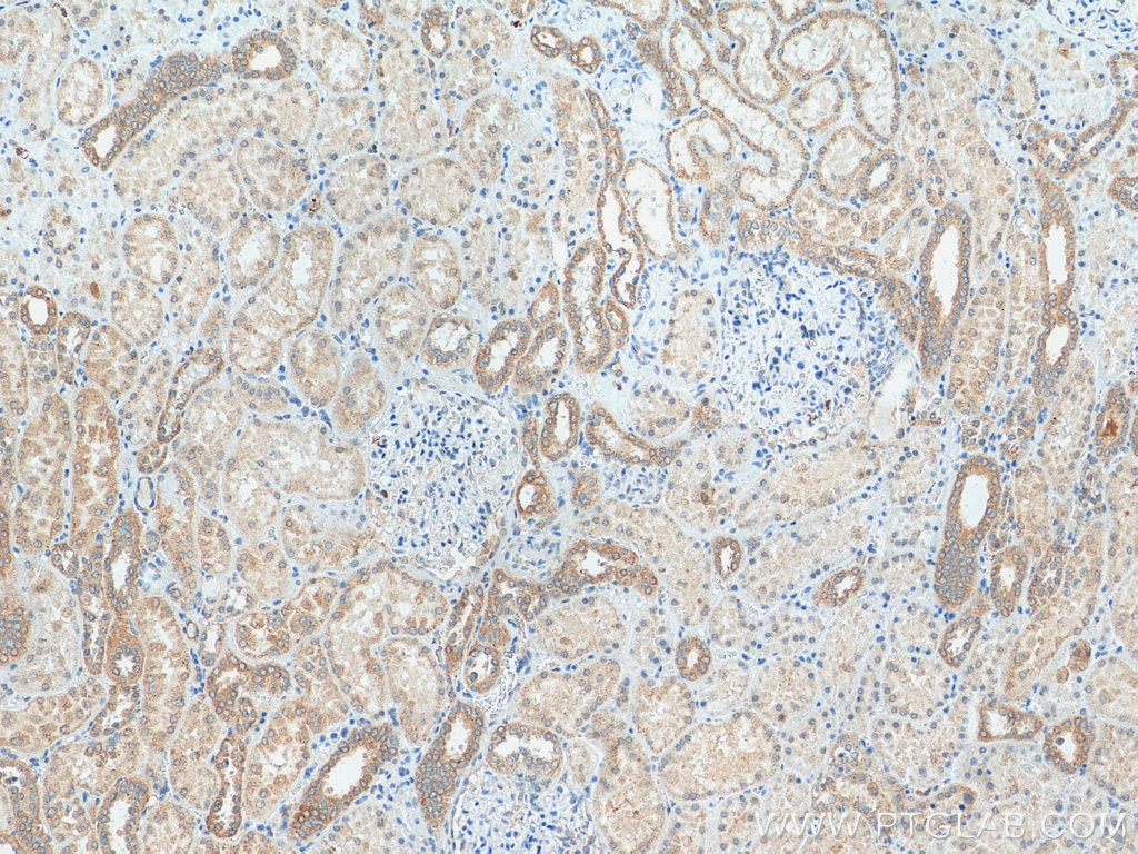 IHC staining of human kidney using 25472-1-AP