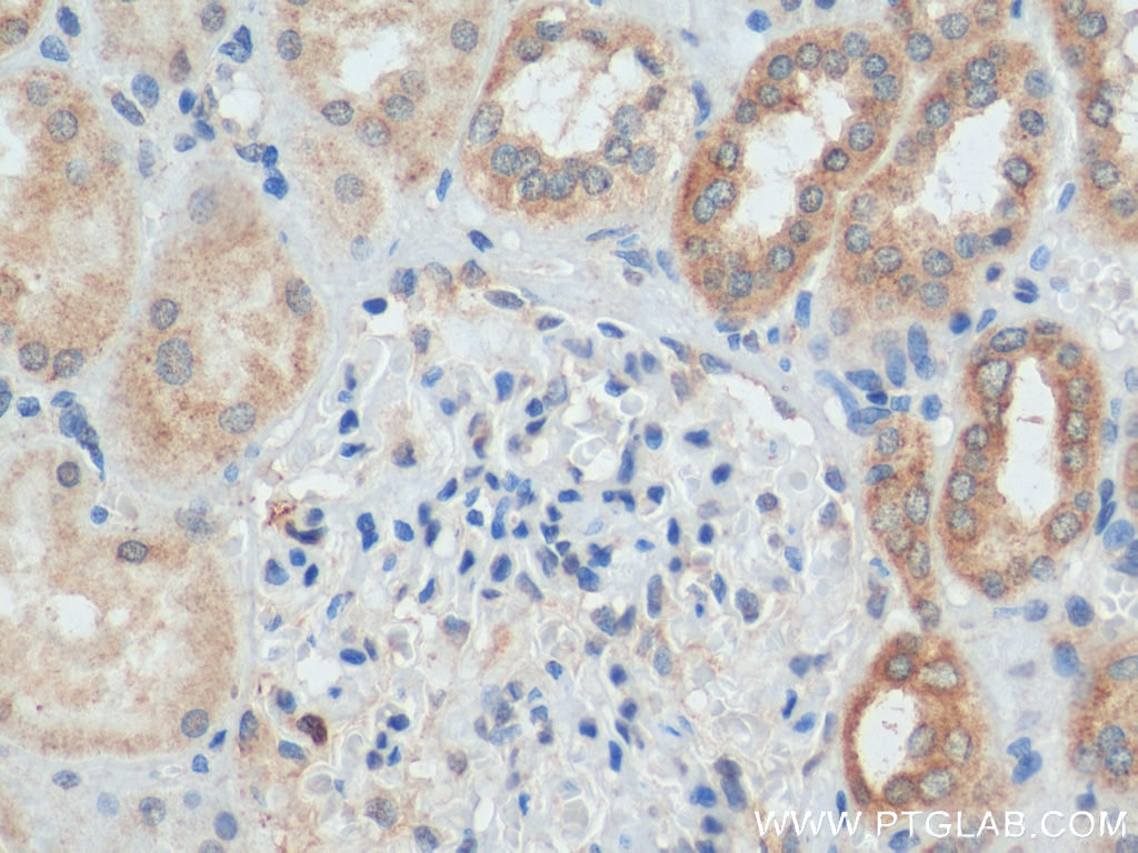 Immunohistochemistry (IHC) staining of human kidney tissue using MXRA5 Polyclonal antibody (25472-1-AP)