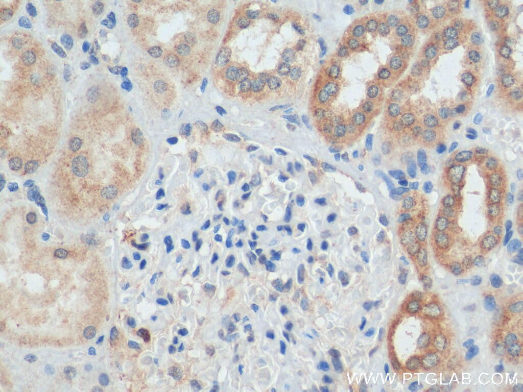 IHC staining of human kidney using 25472-1-AP