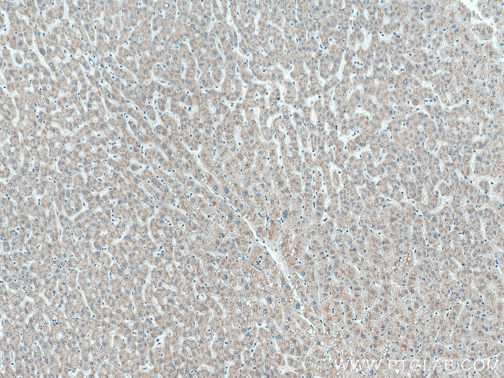 Immunohistochemistry (IHC) staining of human liver tissue using MXRA5 Polyclonal antibody (25472-1-AP)