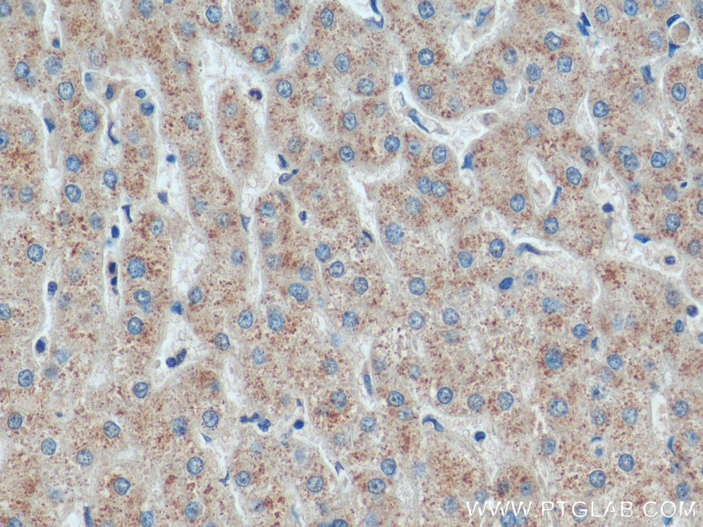 Immunohistochemistry (IHC) staining of human liver tissue using MXRA5 Polyclonal antibody (25472-1-AP)