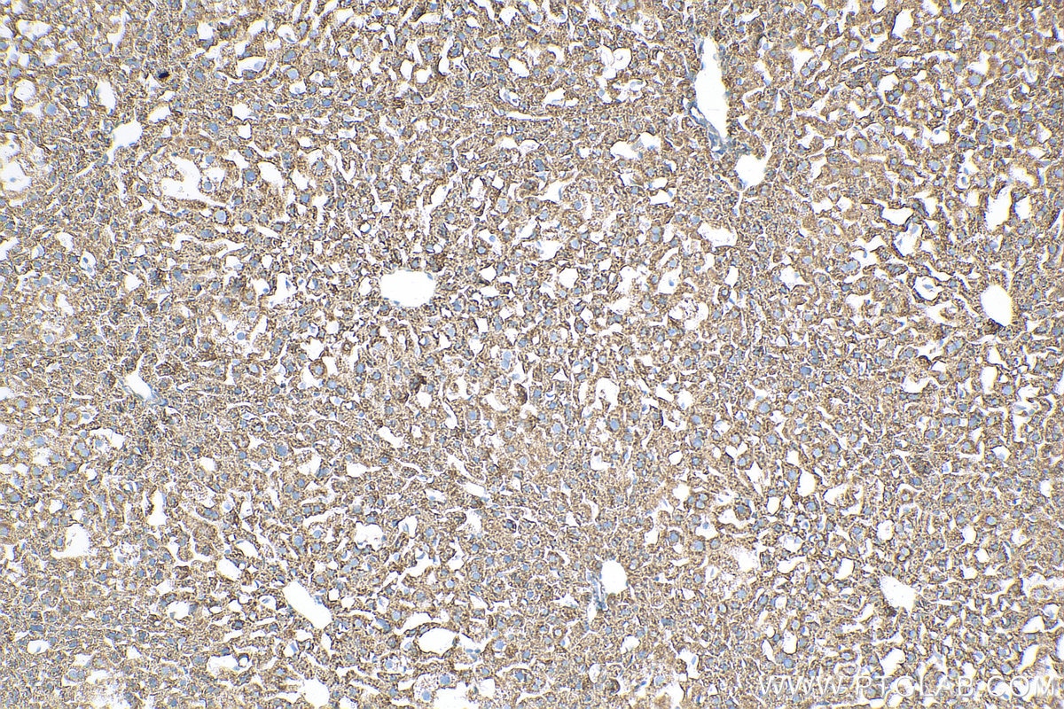 Immunohistochemistry (IHC) staining of mouse liver tissue using MXRA5 Polyclonal antibody (25472-1-AP)