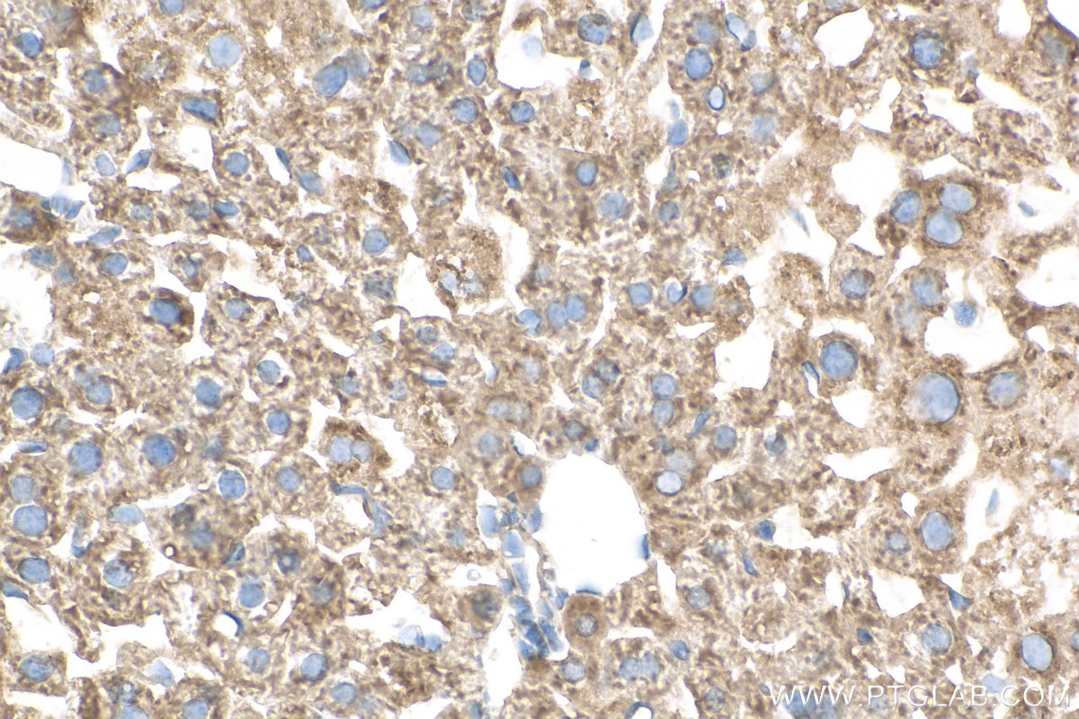 Immunohistochemistry (IHC) staining of mouse liver tissue using MXRA5 Polyclonal antibody (25472-1-AP)