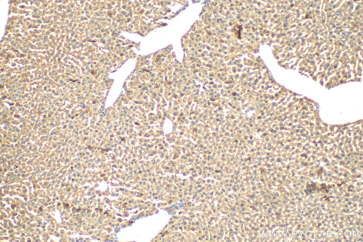 Immunohistochemistry (IHC) staining of mouse liver tissue using MXRA5 Polyclonal antibody (29777-1-AP)