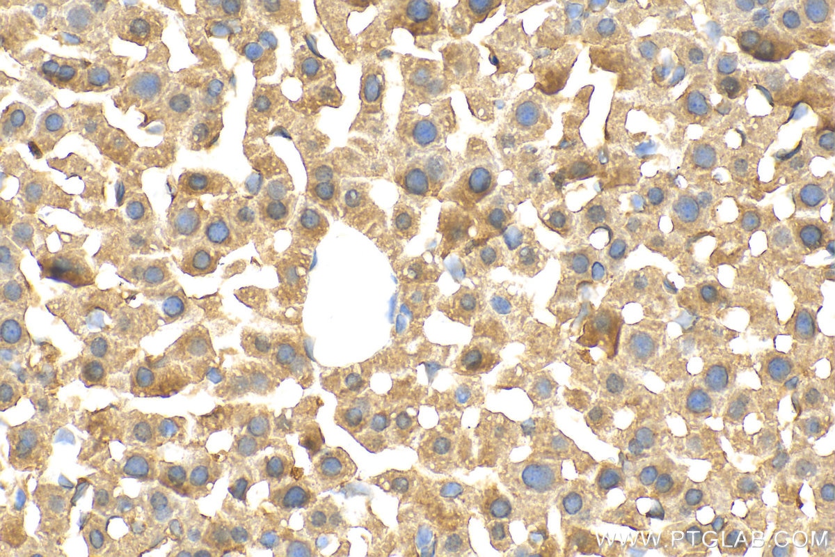 Immunohistochemistry (IHC) staining of mouse liver tissue using MXRA5 Polyclonal antibody (29777-1-AP)
