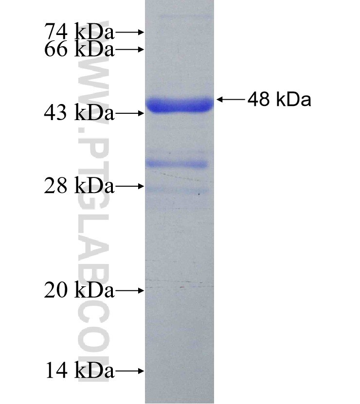 MXRA5 fusion protein Ag31140 SDS-PAGE