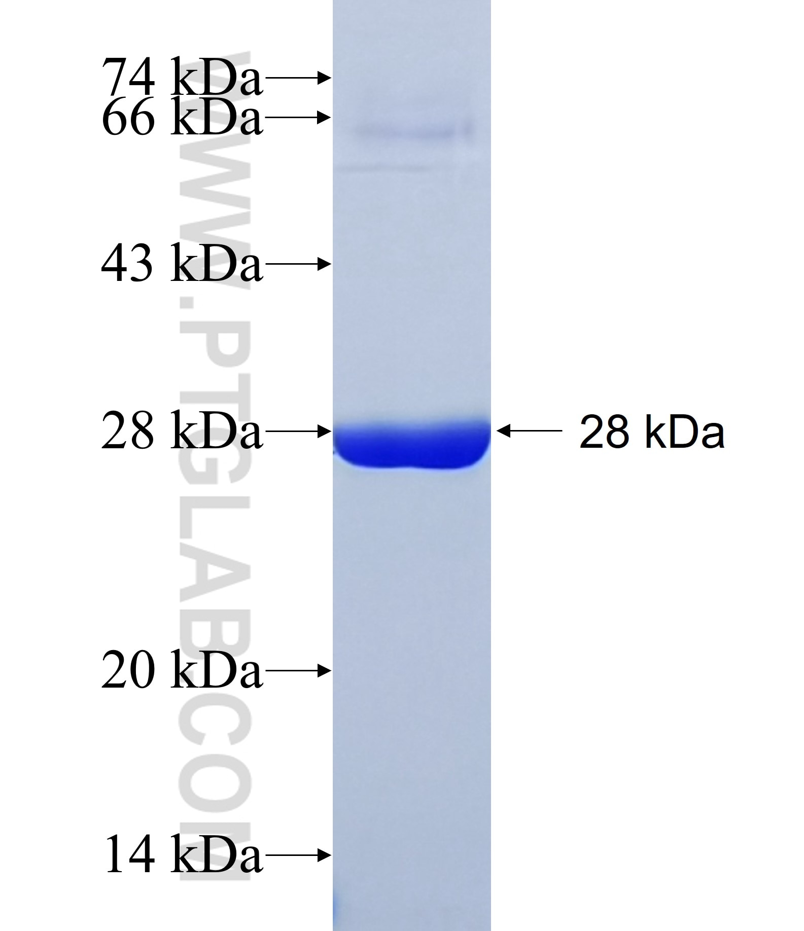 MXRA5 fusion protein Ag31164 SDS-PAGE MXRA5 fusion protein Ag31164 SDS-PAGE