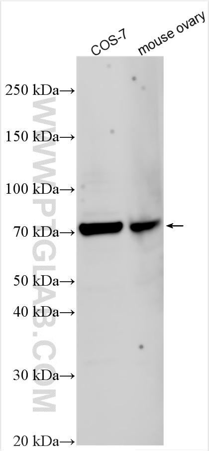 Western Blot (WB) analysis of various lysates using MXRA8 Polyclonal antibody (31581-1-AP)