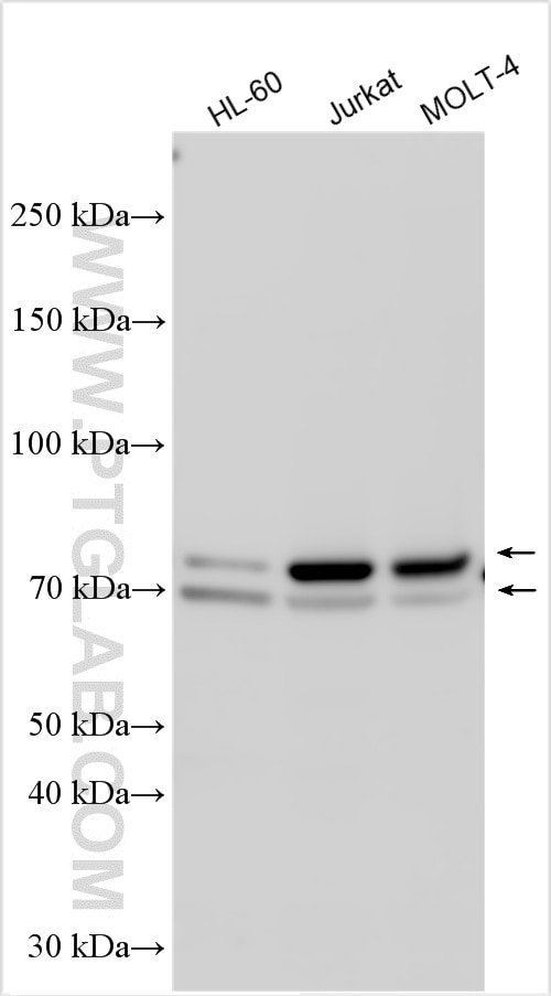 Western Blot (WB) analysis of various lysates using MYB/c-Myb Polyclonal antibody (17800-1-AP)