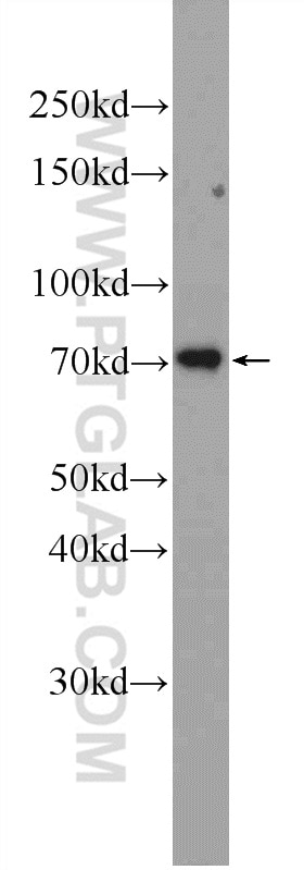 Western Blot (WB) analysis of Jurkat cells using c-Myb Polyclonal antibody (17800-1-AP)