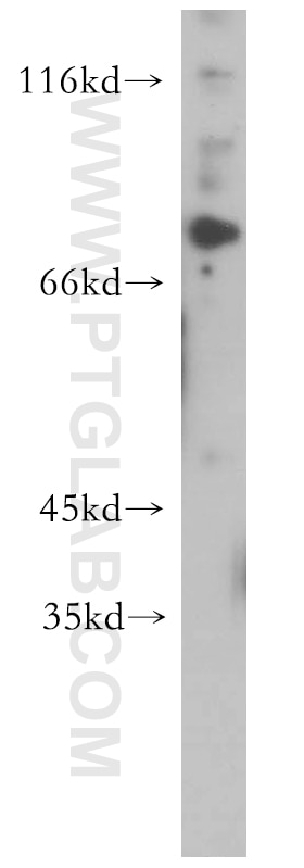 Western Blot (WB) analysis of HL-60 cells using c-Myb Polyclonal antibody (17800-1-AP)