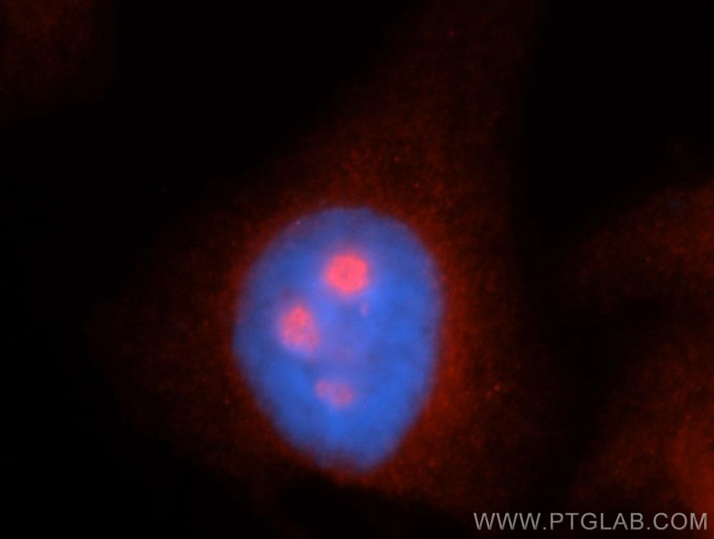 Immunofluorescence (IF) / fluorescent staining of HepG2 cells using MYBBP1A Polyclonal antibody (14524-1-AP)