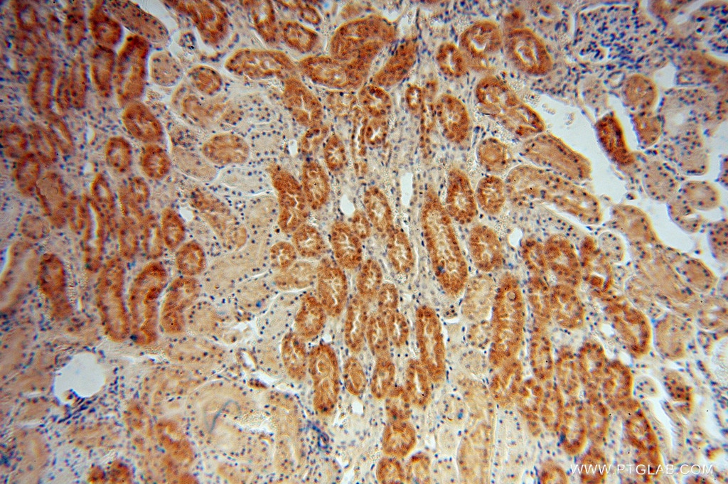 IHC staining of human kidney using 14524-1-AP