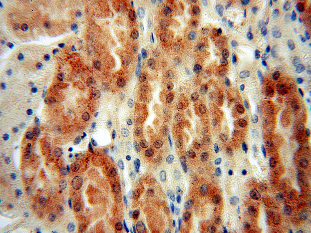 Immunohistochemistry (IHC) staining of human kidney tissue using MYBBP1A Polyclonal antibody (14524-1-AP)