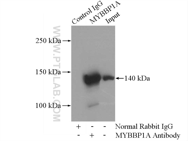 Immunoprecipitation (IP) experiment of HEK-293 cells using MYBBP1A Polyclonal antibody (14524-1-AP)