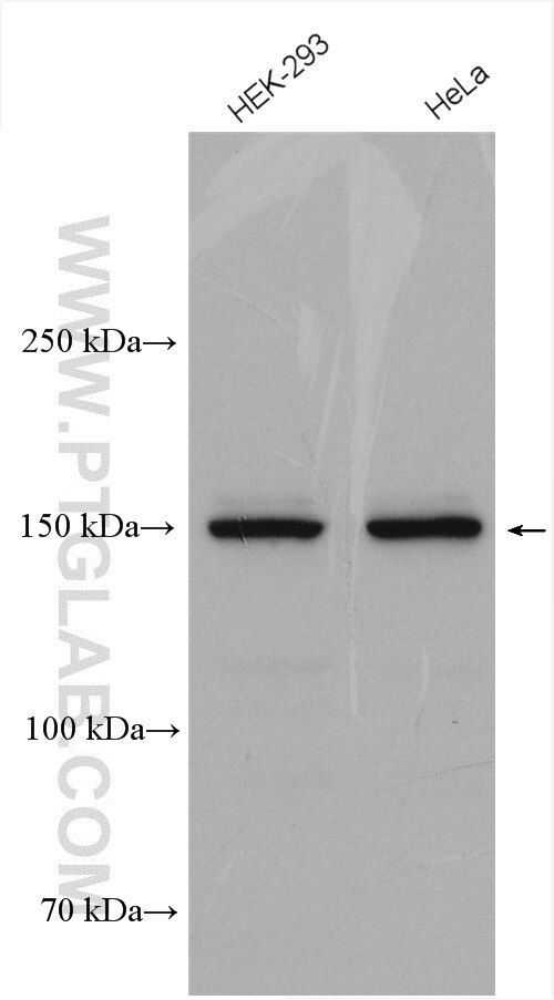 Western Blot (WB) analysis of various lysates using MYBBP1A Polyclonal antibody (14524-1-AP)