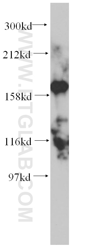 Western Blot (WB) analysis of HEK-293 cells using MYBBP1A Polyclonal antibody (14524-1-AP)