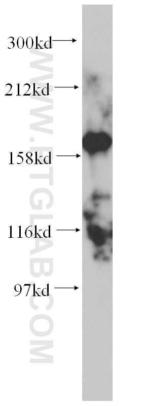 WB analysis of HEK-293 using 14524-1-AP