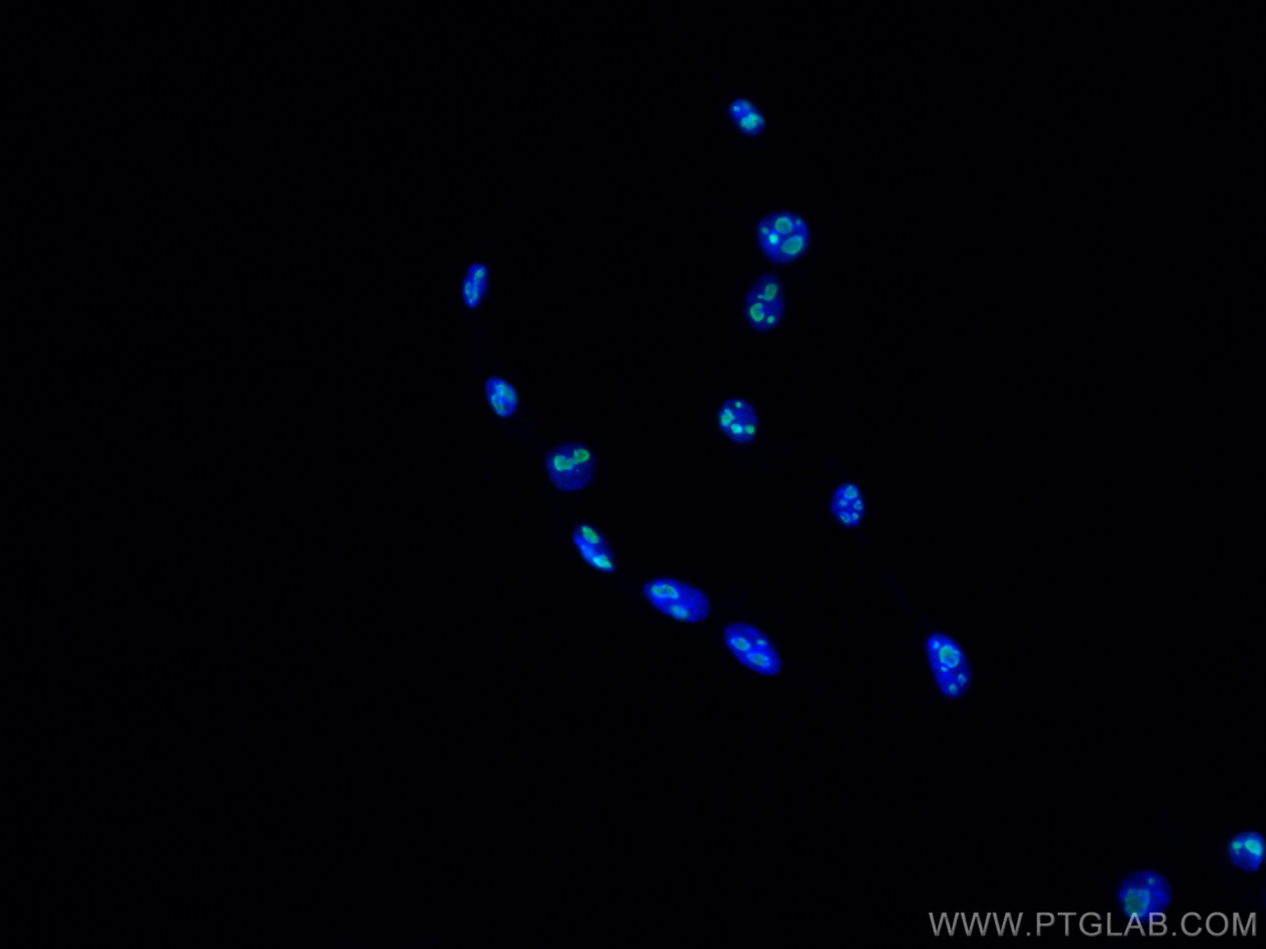 Immunofluorescence (IF) / fluorescent staining of NIH/3T3 cells using MYBBP1A Monoclonal antibody (67996-1-Ig)