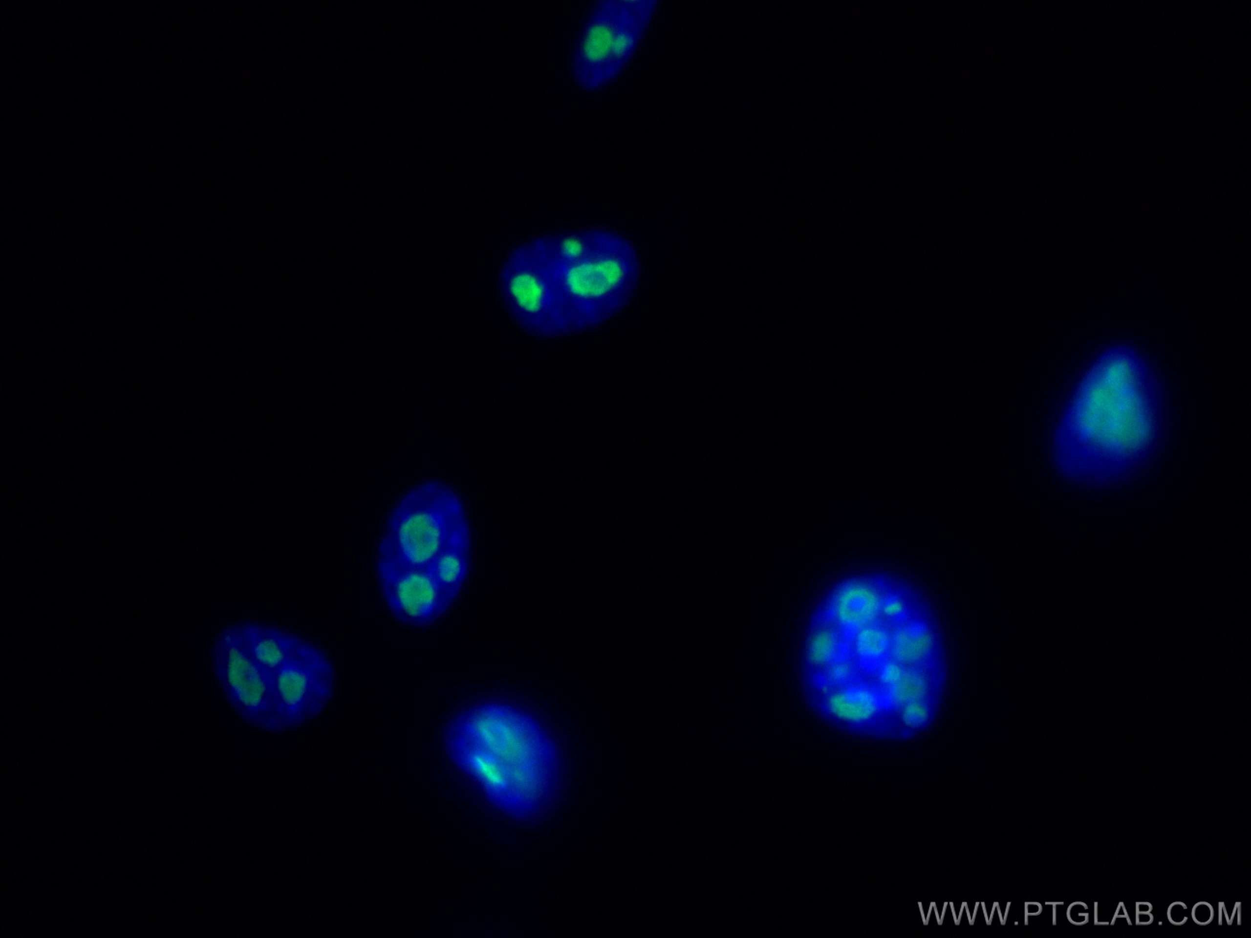 Immunofluorescence (IF) / fluorescent staining of NIH/3T3 cells using MYBBP1A Monoclonal antibody (67996-1-Ig)