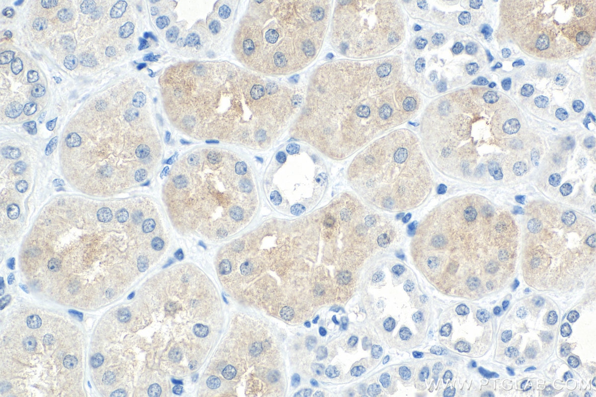 Immunohistochemistry (IHC) staining of human kidney tissue using MYBBP1A Monoclonal antibody (67996-1-Ig)