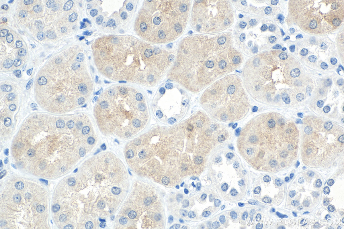 Immunohistochemistry (IHC) staining of human kidney tissue using MYBBP1A Monoclonal antibody (67996-1-Ig)