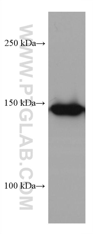 Western Blot (WB) analysis of HSC-T6 cells using MYBBP1A Monoclonal antibody (67996-1-Ig)