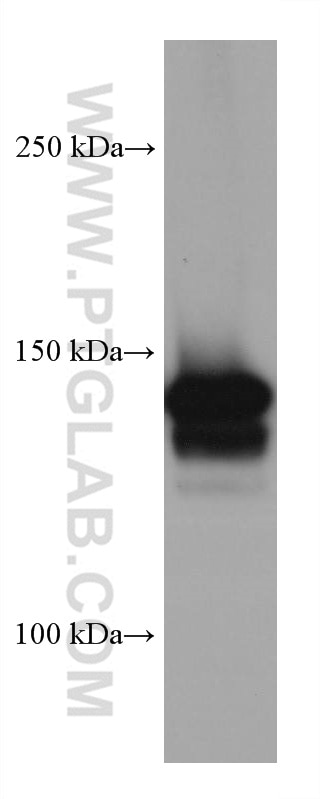 Western Blot (WB) analysis of 4T1 cells using MYBBP1A Monoclonal antibody (67996-1-Ig)