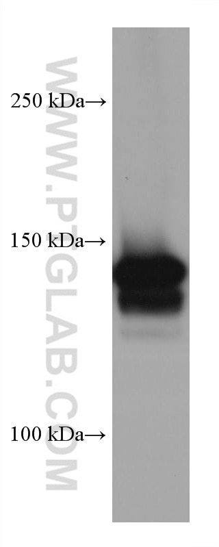 WB analysis of 4T1 using 67996-1-Ig