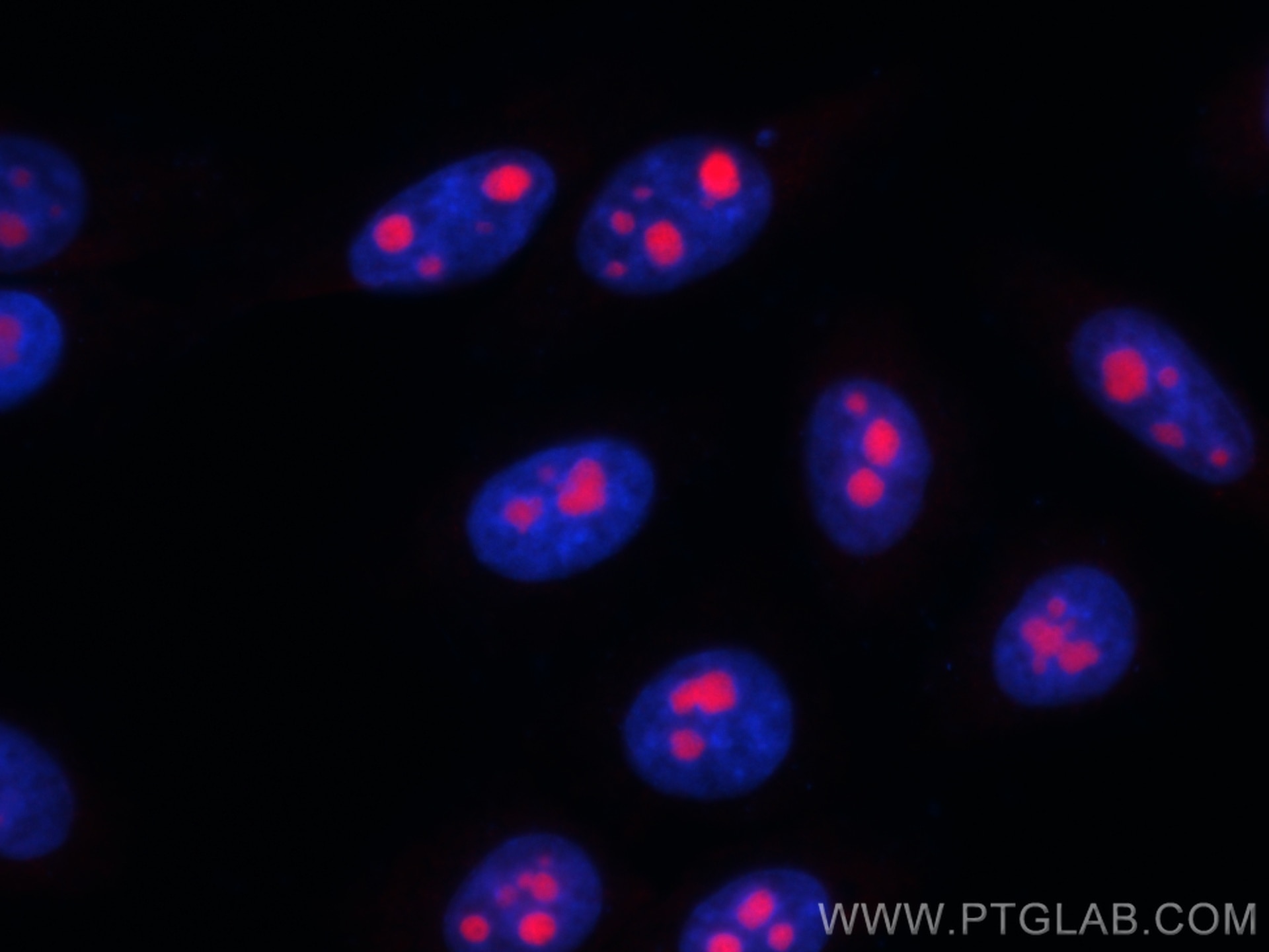 Immunofluorescence (IF) / fluorescent staining of HepG2 cells using CoraLite®594-conjugated MYBBP1A Monoclonal antibod (CL594-67996)