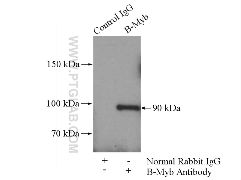 Immunoprecipitation (IP) experiment of HeLa cells using B-Myb Polyclonal antibody (18896-1-AP)