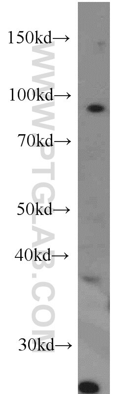 Western Blot (WB) analysis of HeLa cells using B-Myb Polyclonal antibody (18896-1-AP)