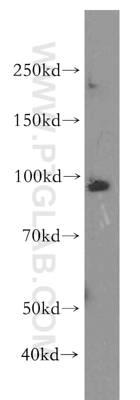 Western Blot (WB) analysis of HeLa cells using B-Myb Polyclonal antibody (18896-1-AP)