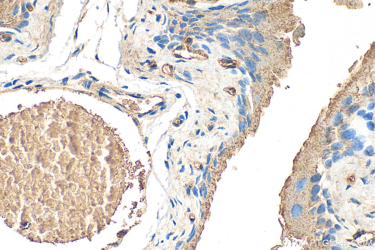 Immunohistochemistry (IHC) staining of mouse bladder tissue using MYBPC1 Polyclonal antibody (22900-1-AP)