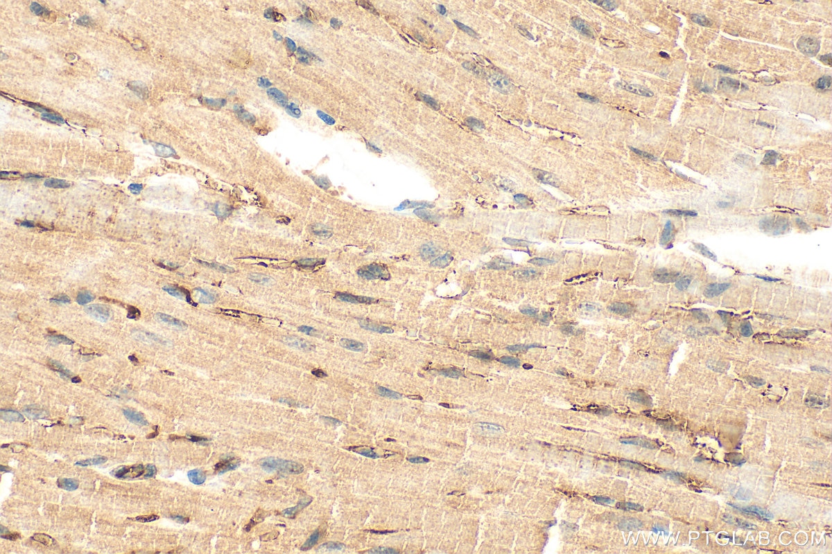 Immunohistochemistry (IHC) staining of mouse heart tissue using MYBPC1 Polyclonal antibody (22900-1-AP)