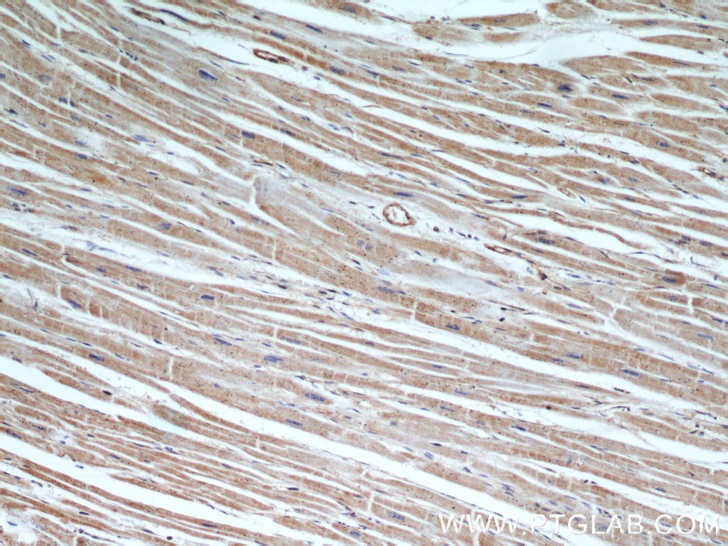 Immunohistochemistry (IHC) staining of human heart tissue using MYBPC1 Polyclonal antibody (22900-1-AP)