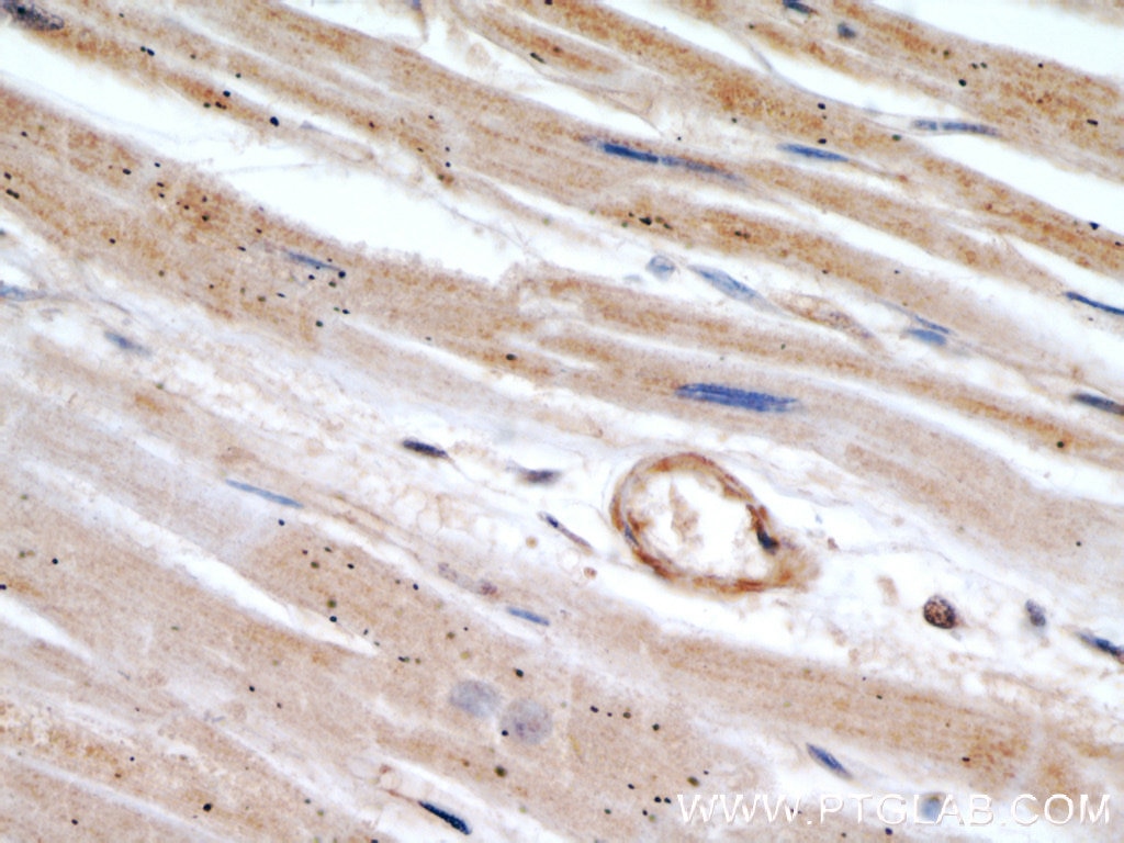 Immunohistochemistry (IHC) staining of human heart tissue using MYBPC1 Polyclonal antibody (22900-1-AP)