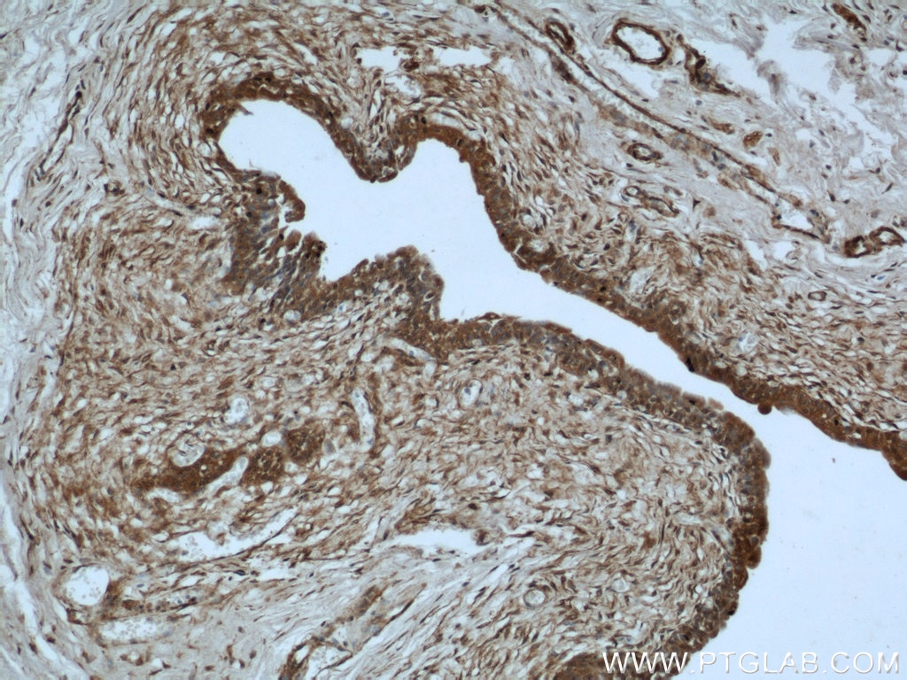 Immunohistochemistry (IHC) staining of human bladder tissue using MYBPC1 Polyclonal antibody (22900-1-AP)