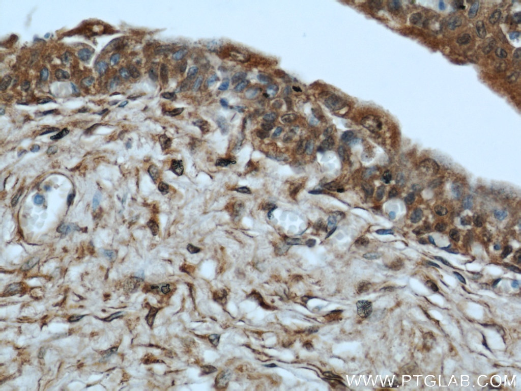 Immunohistochemistry (IHC) staining of human bladder tissue using MYBPC1 Polyclonal antibody (22900-1-AP)