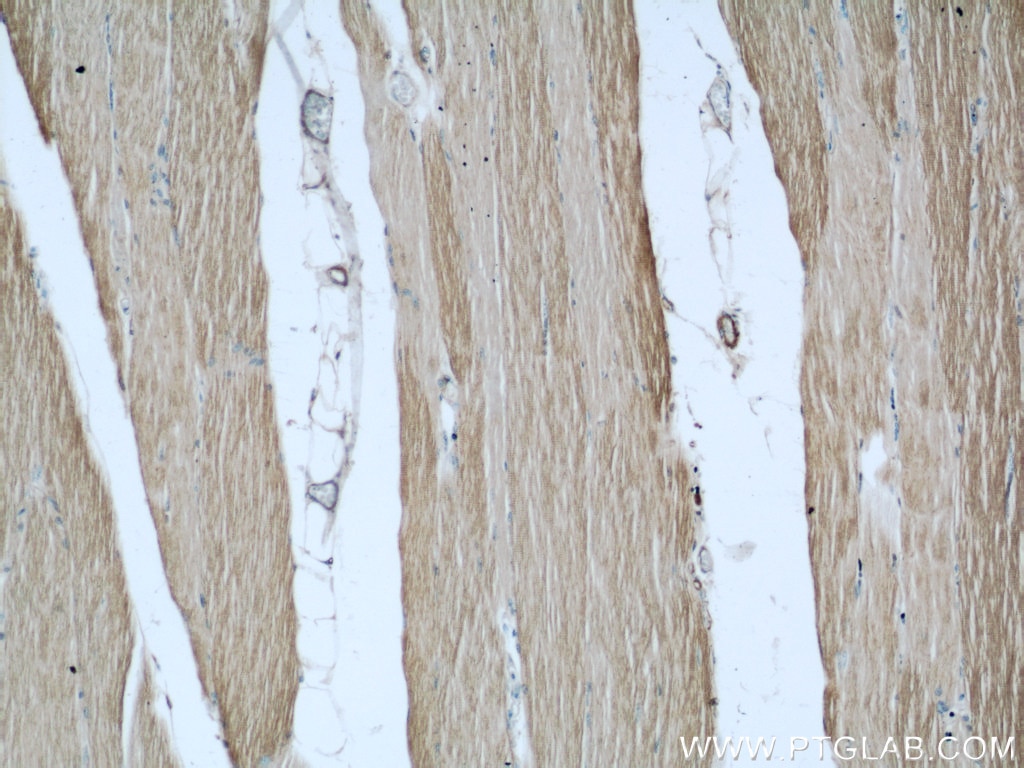 Immunohistochemistry (IHC) staining of human skeletal muscle tissue using MYBPC1 Polyclonal antibody (22900-1-AP)