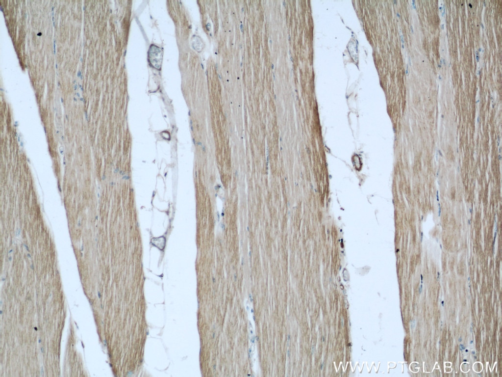 Immunohistochemistry (IHC) staining of human skeletal muscle tissue using MYBPC1 Polyclonal antibody (22900-1-AP)