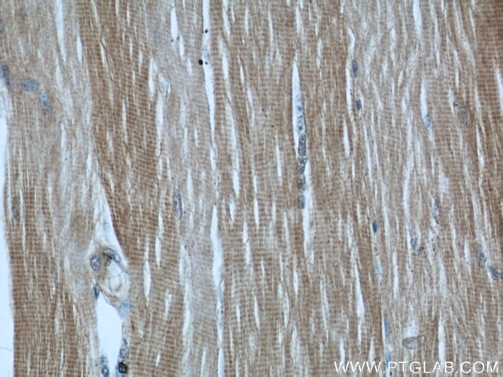 Immunohistochemistry (IHC) staining of human skeletal muscle tissue using MYBPC1 Polyclonal antibody (22900-1-AP)