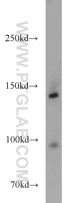 Western Blot (WB) analysis of mouse pancreas tissue using MYBPC1 Polyclonal antibody (22900-1-AP)