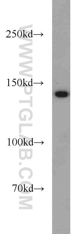 Western Blot (WB) analysis of mouse skeletal muscle tissue using MYBPC1 Polyclonal antibody (22900-1-AP)